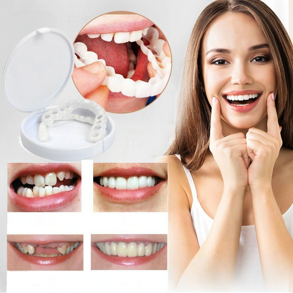 Tooth Repair™ | ALTIJD DE PERFECTE GLIMLACH